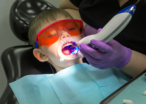 Child in the dental chair receiving dental sealants