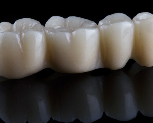 dental crowns in brenham