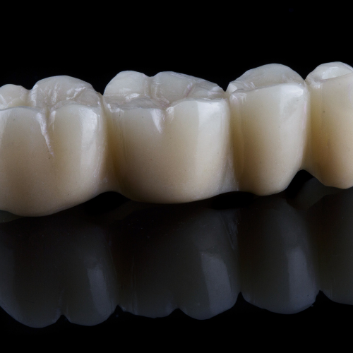 1 Best Guide To Dental Crowns in Brenham