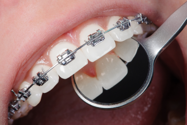 Orthodontic care Orthodontics Orthodontist Orthodontic treatment Braces Clear aligners Invisalign Brenham, Texas Smile Dental health Oral health Teeth alignment Straight teeth Misaligned teeth Crooked teeth Overbite Underbite Crossbite Dental provider Orthodontic issues